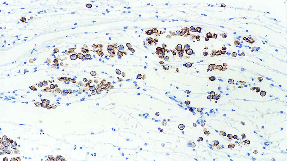 Mesothelin product photo Front View S