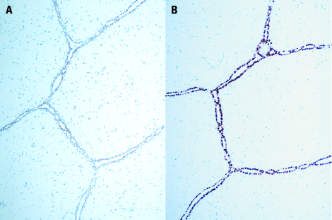 Progesterone Receptor (A/B Forms) product photo Front View S