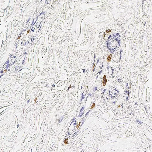 Mast Cell Tryptase product photo Front View S