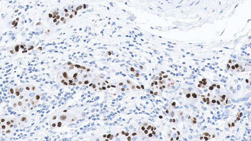 Progesterone Receptor product photo Front View S