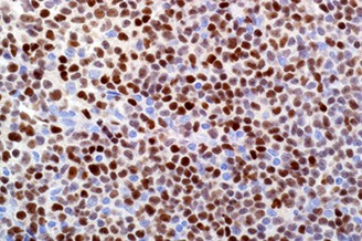 7ML SOX-11 (MRQ-58 Mab) 'CM' product photo