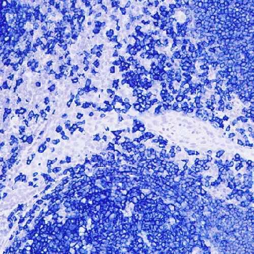 Blue Chromogen product photo Front View S