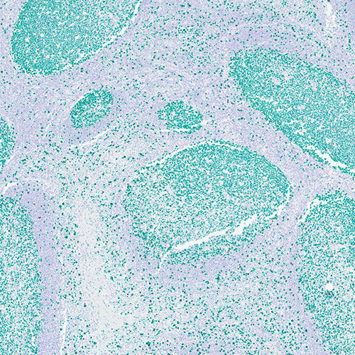 Green Chromogen product photo Front View S