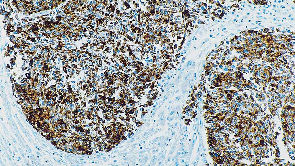 Prostate Specific Membrane Antigen product photo Front View S