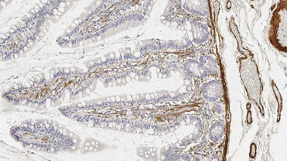 SMA (Alpha Smooth Muscle Actin) product photo Front View S