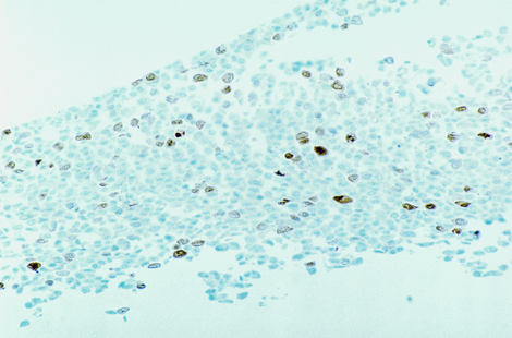 Aurora Kinase 2 product photo Front View S