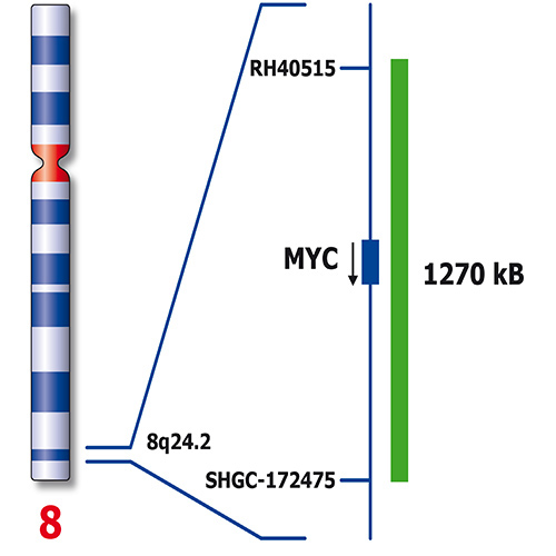 IVD MYC/IGH t(8;14) Fusion photo produit Back View S