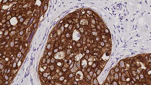 Cytokeratin, Multi (AE1/AE3) photo produit Front View S