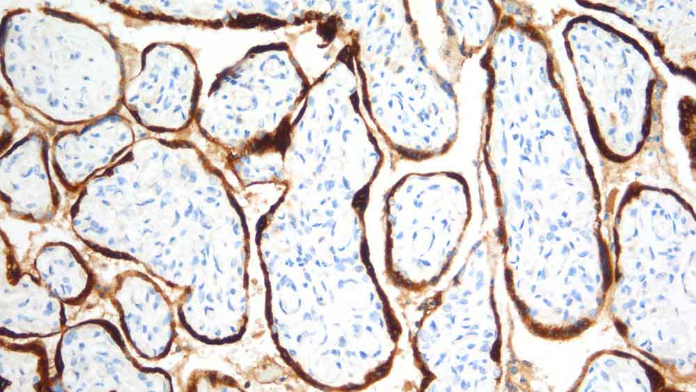 Human Chorionic Gonadotrophin (beta) photo produit Front View S