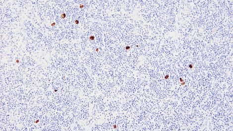 7mL NCL RTU EBER Probe-ASR photo produit