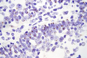 BOND HPV 16/18/31/33/51 Probe photo produit Front View S