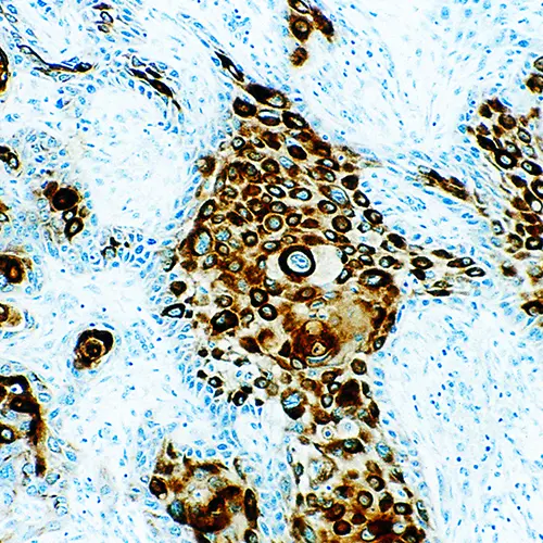 Cytokeratin, Multi (5/6/8/18) photo produit Front View S