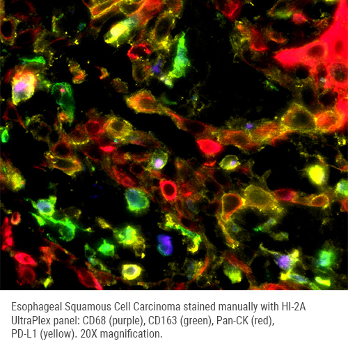 HI-2A mxIF - CD68/CD163/PanCK/PD-L1 photo produit
