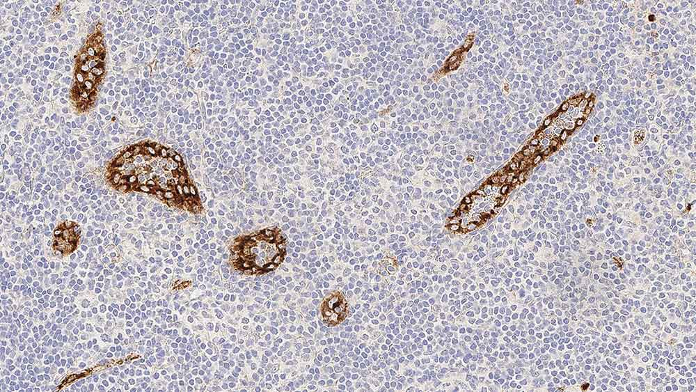 von Willebrand Factor (Factor VIII-related antigen) photo produit Front View S
