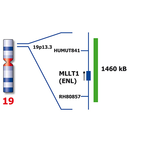 IVD KMT2A/MLLT1 product photo Side View S