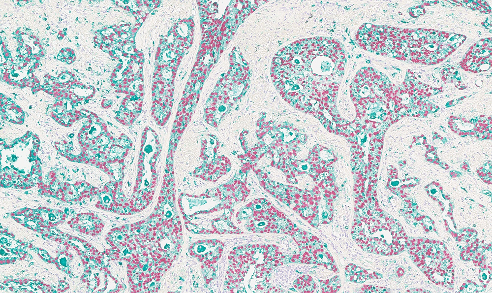 BOND Chromoplex II Dual Detection product photo
