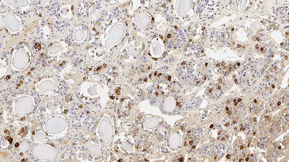 Human Follicle Stimulating Hormone (beta 2) (HFSH) product photo Front View S