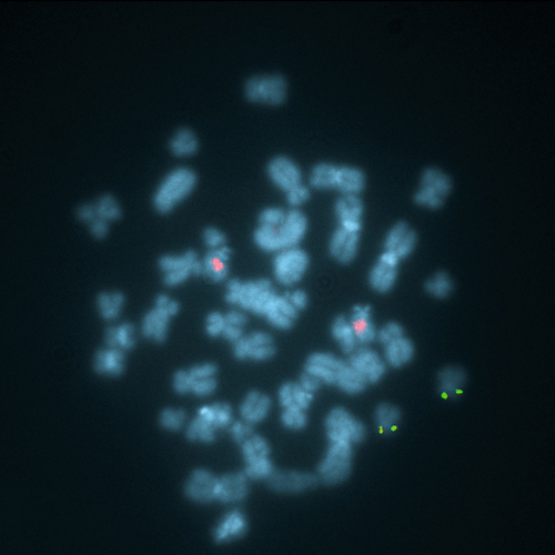 ON DLEU (13q14) / p53 (17p13) product photo