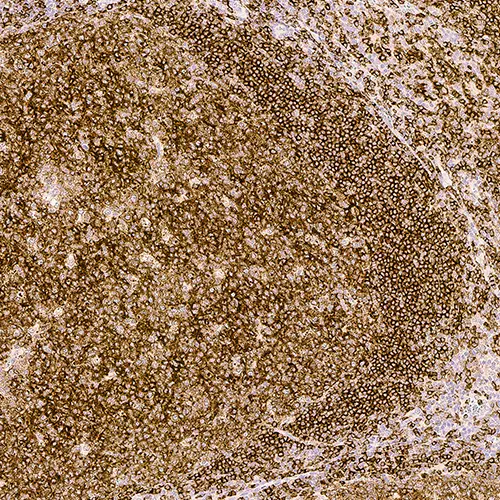 CD22 product photo Front View S
