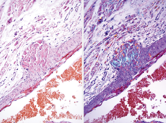 Congo Red, Amyloid Special Stain Kit product photo Front View S
