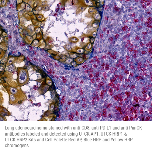 UltraTag HRP1 Multiplex Labeling Kit product photo