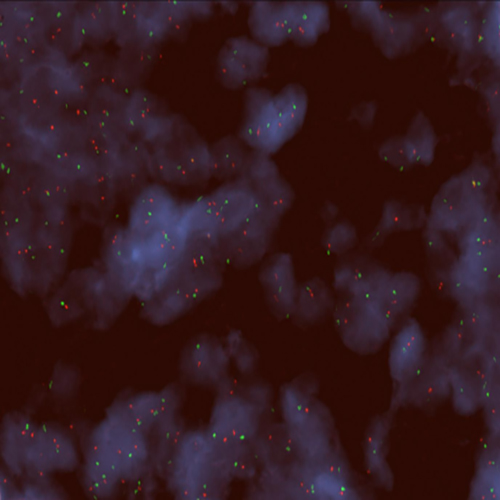 ON p53 (17p13) / SE 17 (tissue) 製品画像