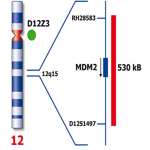 IVD MDM2/SE 12 製品画像 Back View S
