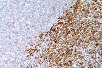 7ML Glypican-3 (1G12 Mab) 'CM' 製品画像