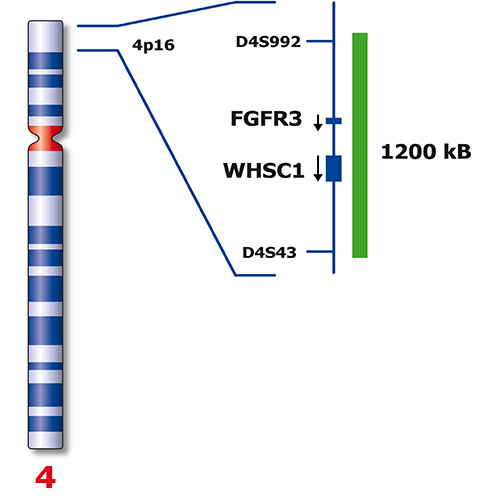 IVD FGFR3/IGH 製品画像 Back View S