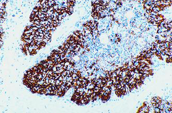 ???1412?NCL-L-DEC205 :CD205 (DEC-205):1m 製品画像