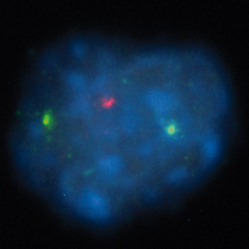 ON MM 19q13 / p53 (17p13) 製品画像