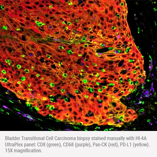 HI-4A mxIF - CD8/CD68/PanCK/PD-L1 製品画像