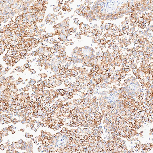 7mL Podoplanin (D2-40) Bond RTU 製品画像