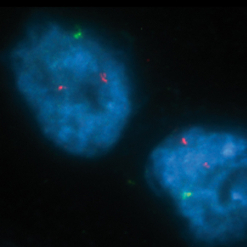 IVD MAF/ IGH Foto do produto Front View S