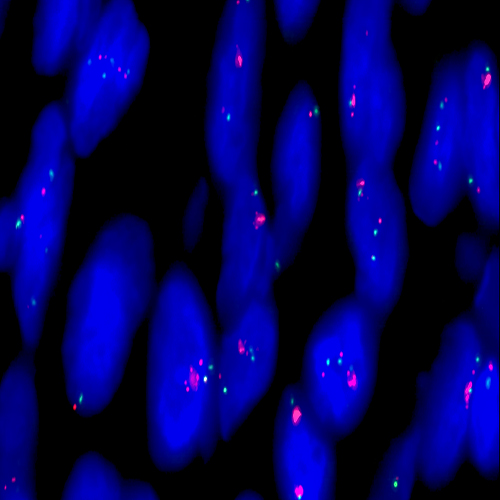 IVD FGFR1 (8p11) / SE8 (D8Z1) - XL for BOND Foto do produto Front View S