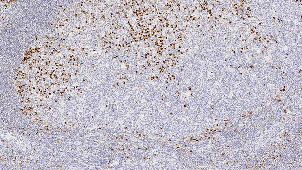 Oncogene de mieloma múltiplo 1 (MUM-1) Foto do produto Front View S