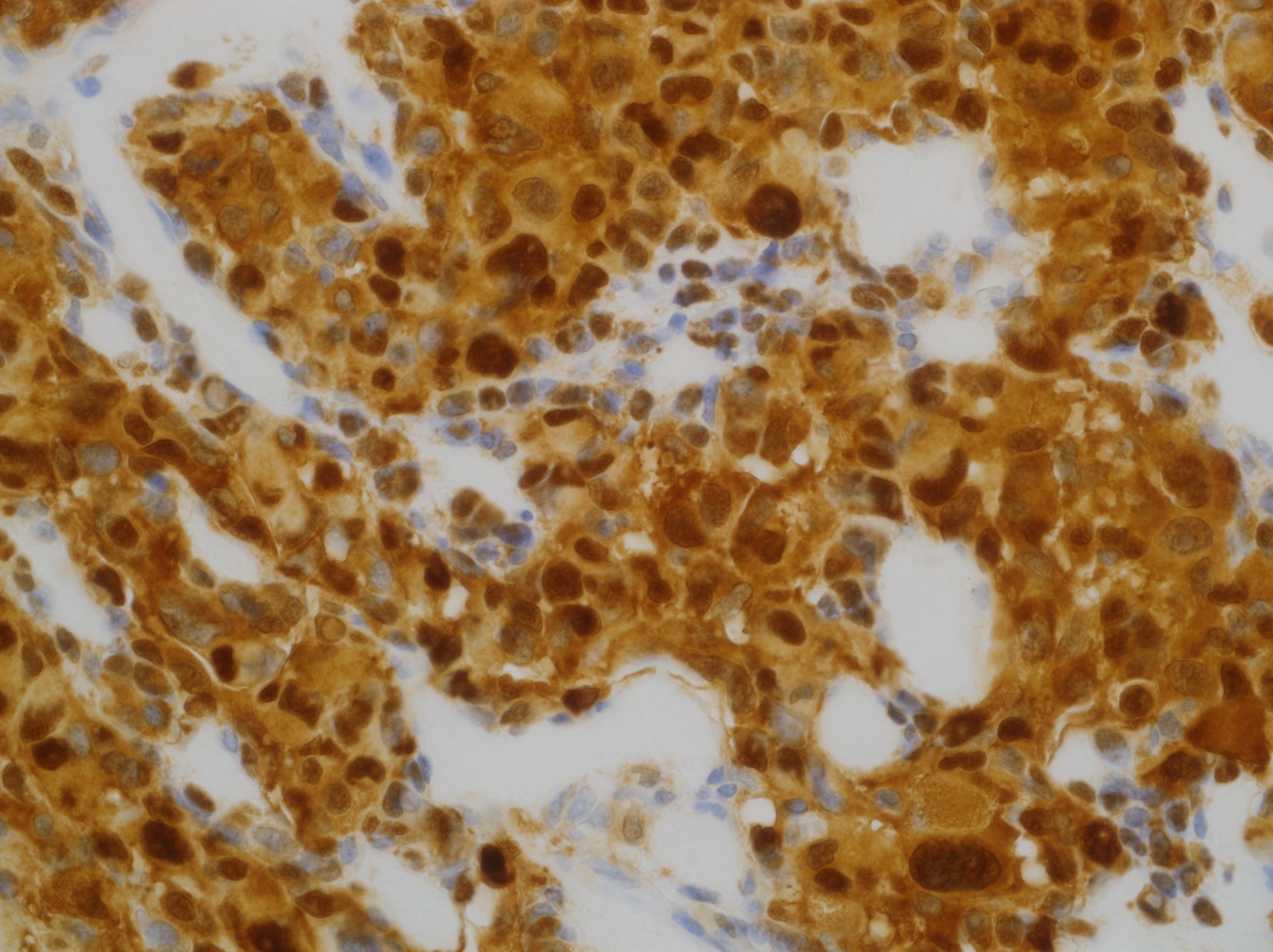 7ML (4C4.9 MAB) S100 Protein 'CM' Foto do produto