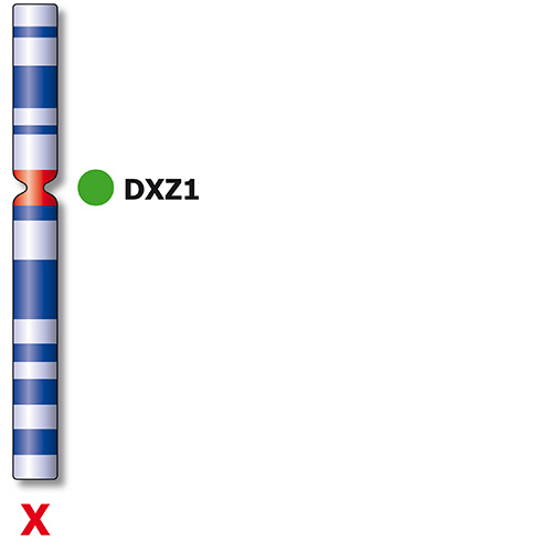 IVD SE X/SE Y Foto do produto Back View S