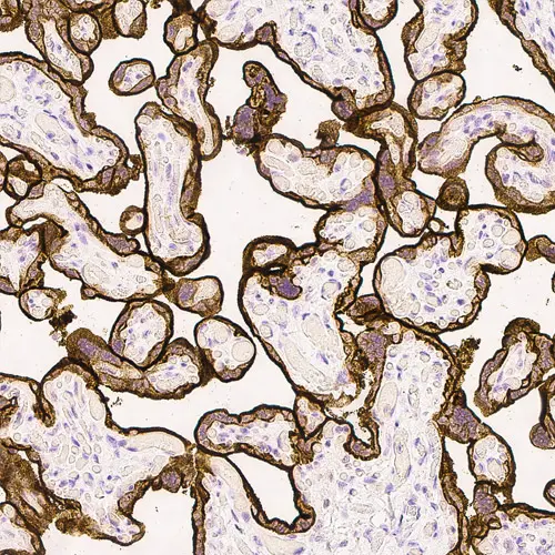 Epidermal Growth Factor Receptor Foto do produto Front View S