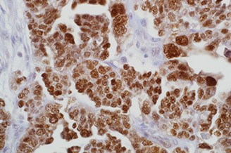 7ML PAX8 (MRQ-50 Mab) 'CM' 产品照片