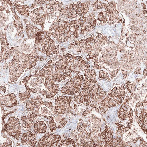 7ml PD-L1 (CAL10) BOND RTU Primary RUO 产品照片