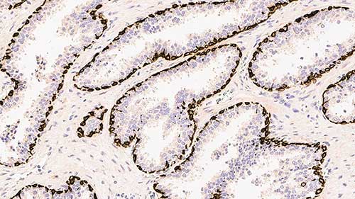 Cytokeratin (High Molecular Weight) 产品照片 Front View S