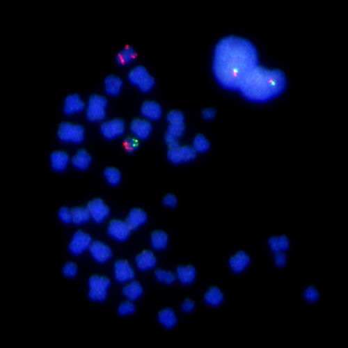 TP53 (17p13) / MPO (17q22) ISO 17q 产品照片