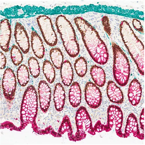 ChromoPlex III Triple Detection RUO 产品照片 Top View S