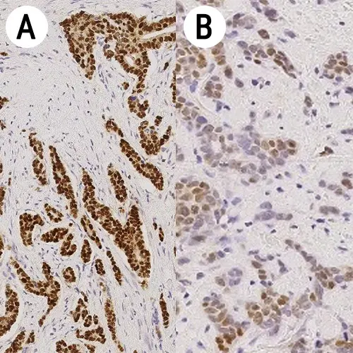Estrogen Receptor 产品照片 Front View S