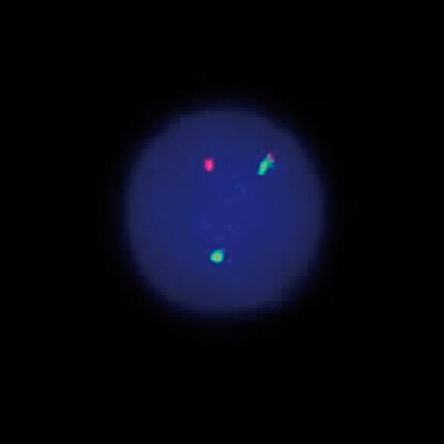 IVD RARA Break product photo Front View S