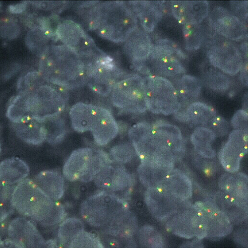 IVD BCL2 Break (tissue) product photo Front View S