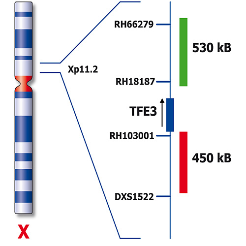 IVD TFE3 Break product photo Back View S
