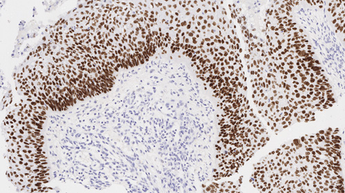 7mL p40 (BC28) Bond RTU Primary product photo