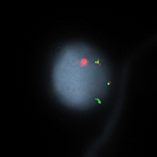 IVD ETV6/RUNX1 产品照片 Front View S